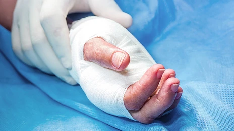 Ein Mitarbeitender der Plastischen Chirurgie verbindet die Hand eines Patienten. 
